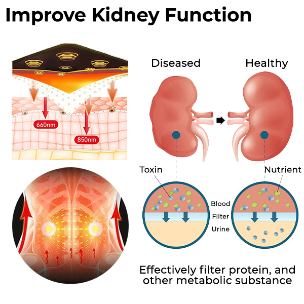 Acupressure Kidney Care Belt